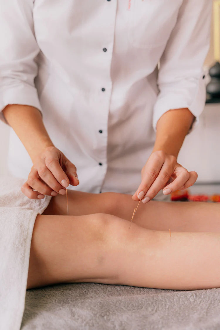 Akupunktúra szakember tűket szúr a beteg lábába-akupunktúra egy alternatív kezelési mód gerincsérv esetén