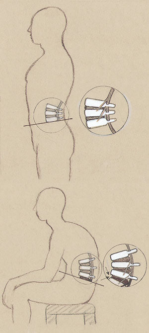 barnás grafika ami a görnyedt és a helyes, lordózisos állapotban mutatja az ágyéki porckorongok helyzetét