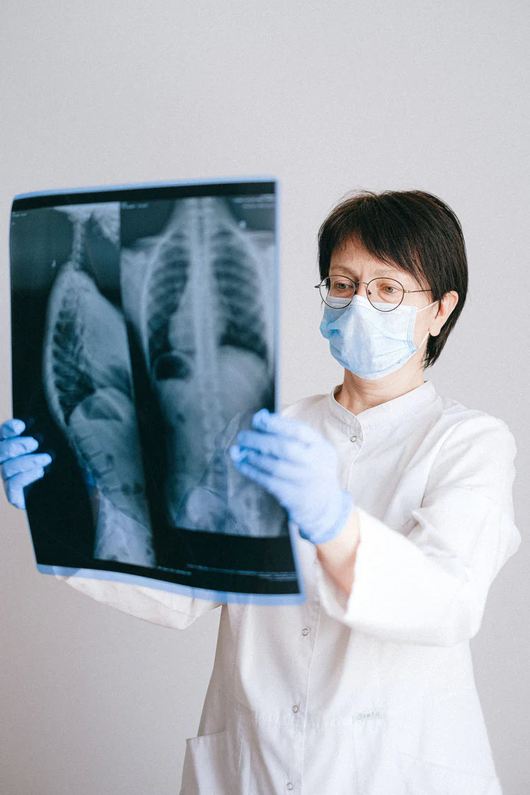 Doktornő röntgen felvételt néz. A röntgen a gerincsérv diagnosztika egyik fontos eszköze.